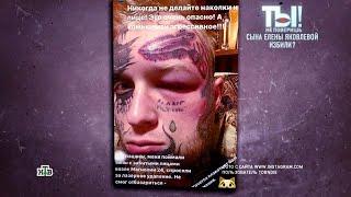 Синяки и отеки: лицо сына Яковлевой после сведения татуировок