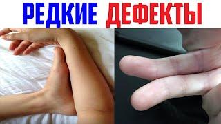 Интересные факты в мире. РЕДКИЕ ДЕФЕКТЫ