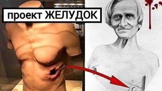 ЧЕЛОВЕК ЧЕЙ ЖЕЛУДОК ВИДЕЛ СВЕТ